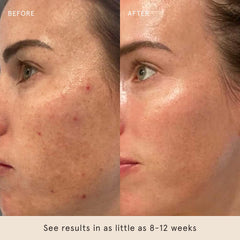 Barefaced Retinal Skin Therapy in a nighttime routine setup