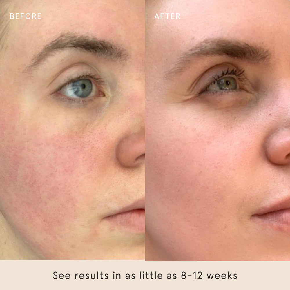 Barefaced SPF50 with niacinamide and hyaluronic acid supports hydration