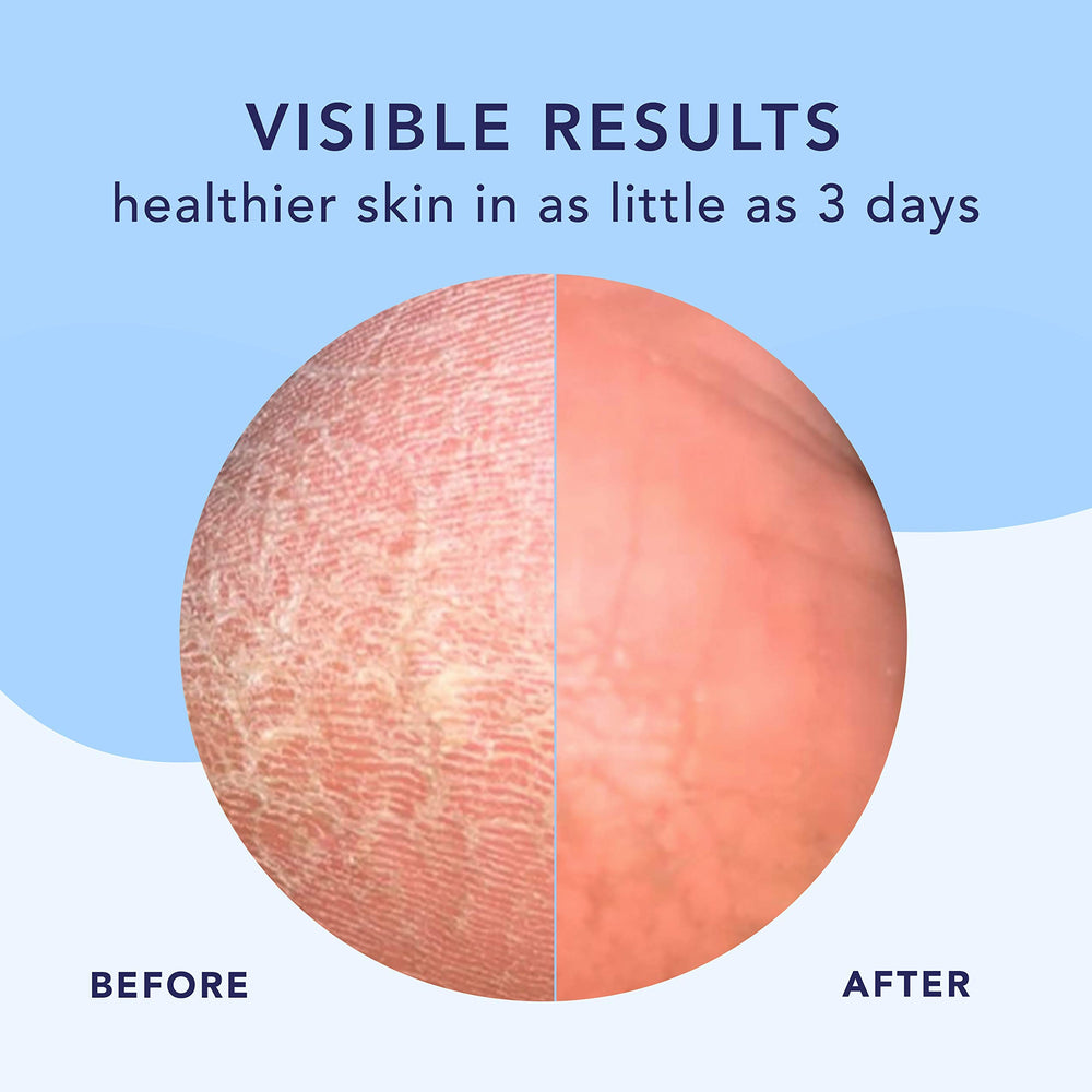 Barefoot Scientist High Dive texture closeup highlighting creamy hydration for cracked heels
