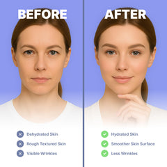 Bayside Forehead Wrinkle Patches designed for night use around the brows