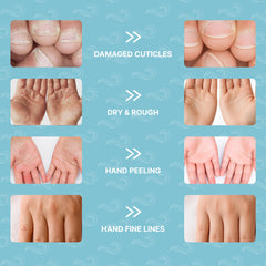 Bayside Snail Mucin and Shea Butter nourish dry skin in glove form.