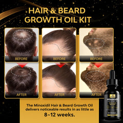 Beaueli Minoxidil beard kit box showing full kit for at-home use