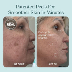 Beautiste 30 Day Miracle packaging front view for product familiarity
