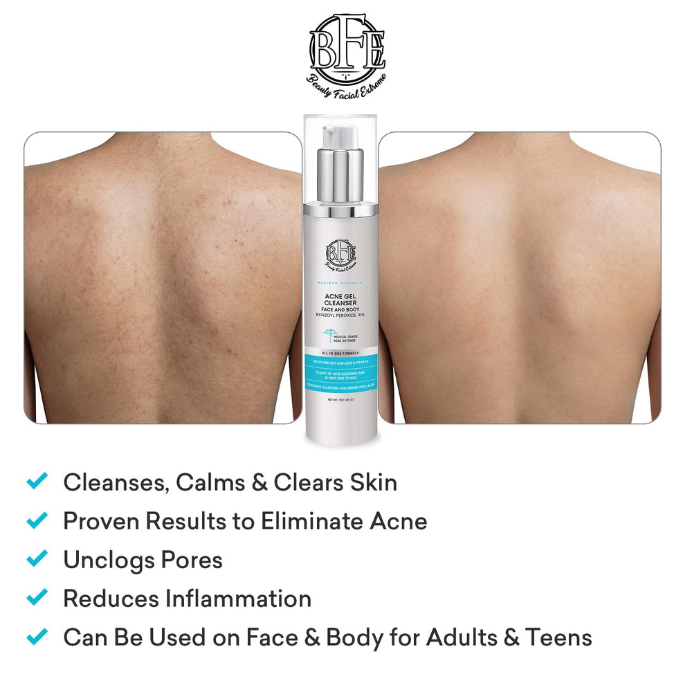 Beauty Facial Extreme result image suggesting fresh, oil-controlled skin after wash.