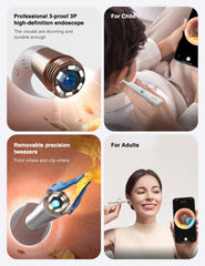 BEBIRD Earsight Plus ENT attachments expand your inspection toolkit
