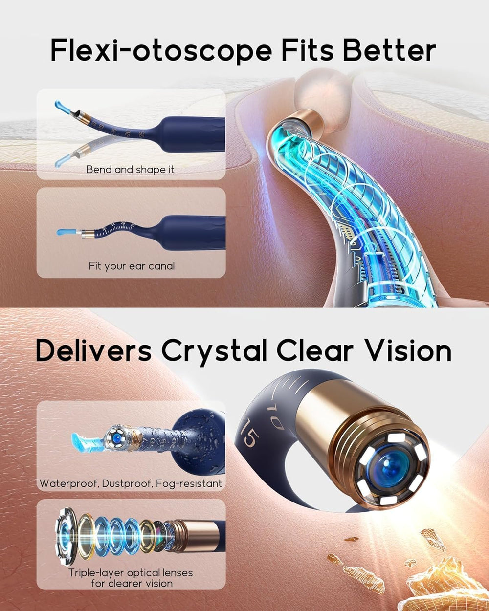 BEBIRD Earsight Plus D39R painless ear tweezers target debris safely and gently