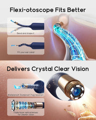 BEBIRD Earsight Plus D39R painless ear tweezers target debris safely and gently