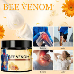 Bee Venom Joint Cream packaging box, travel-friendly size.