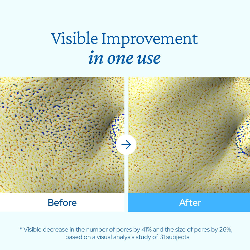 Belif Aqua Bomb lightweight texture on dry skin delivers non-sticky hydration.