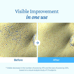 Belif Aqua Bomb lightweight texture on dry skin delivers non-sticky hydration.