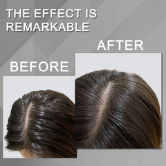 BENIX Dry Shampoo close-up showing no white residue on hair.