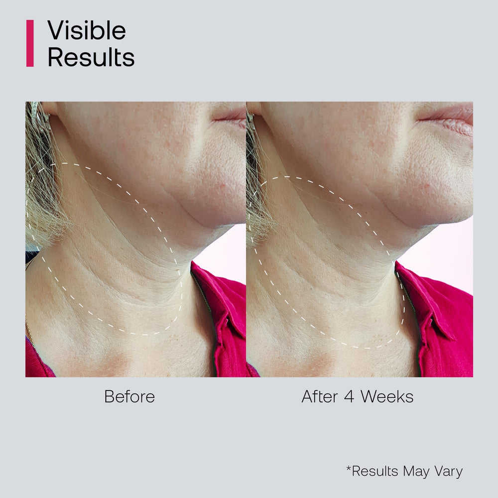 Bestkiss decollete area treatment highlights targeted care for chest lines