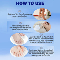 BFGCKJ patches may improve nail appearance by reducing yellowing over time