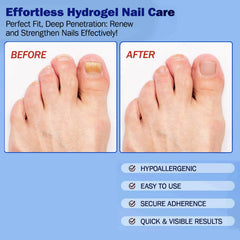 BFGCKJ patch on nail bed supporting moisture balance