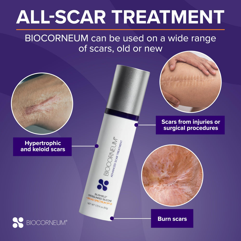 BIOCORNEUM burn scar care to minimize appearance over time.