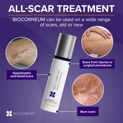 BIOCORNEUM burn scar care to minimize appearance over time.