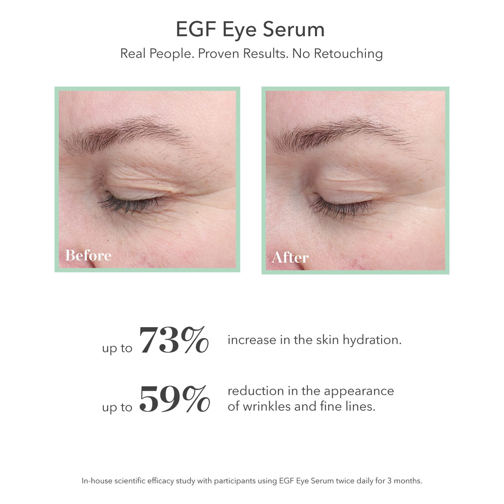Chilled Bioeffect EGF Eye Serum provides added relief for puffy eyes.
