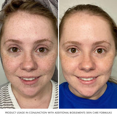 Bioelements Beyond Hydration ingredients highlight vitamin B5 for moisture support.