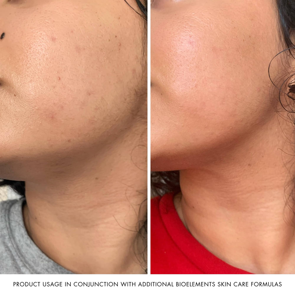 Bioelements vc10 Daily Glow with vitamin E and hyaluronic acid hydrates