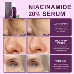 Bioglossy Niacinamide Serum close-up highlighting pore-refining action.