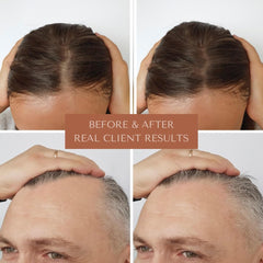 Bioregen Co Rapid Hair Growth Oil application demonstrated with hands massaging the scalp.