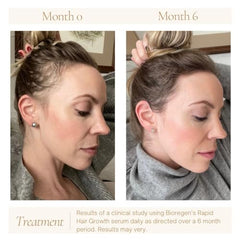 Bioregen Co Rapid Hair Growth Oil label highlights organic rosemary, pumpkin seed, and Batana oils.