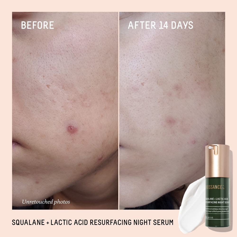 BIOSSANCE Rapid Radiance Set cream swatch showing nourishing hydration