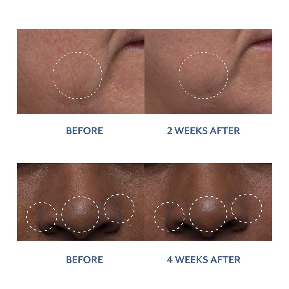 Bloomeffects Tulip Dew Drops droplet being dispensed indicates easy, precise application