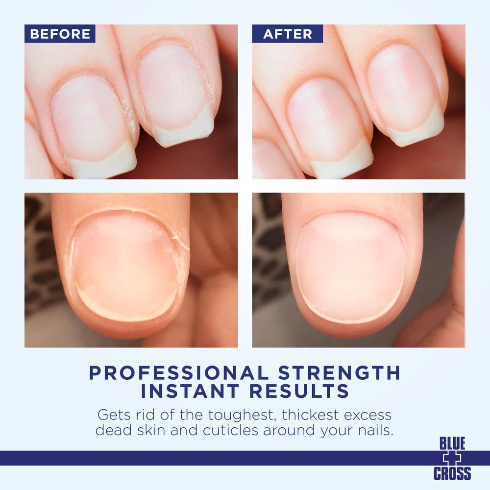 Blue Cross cuticle remover cream in use dissolving stubborn cuticles