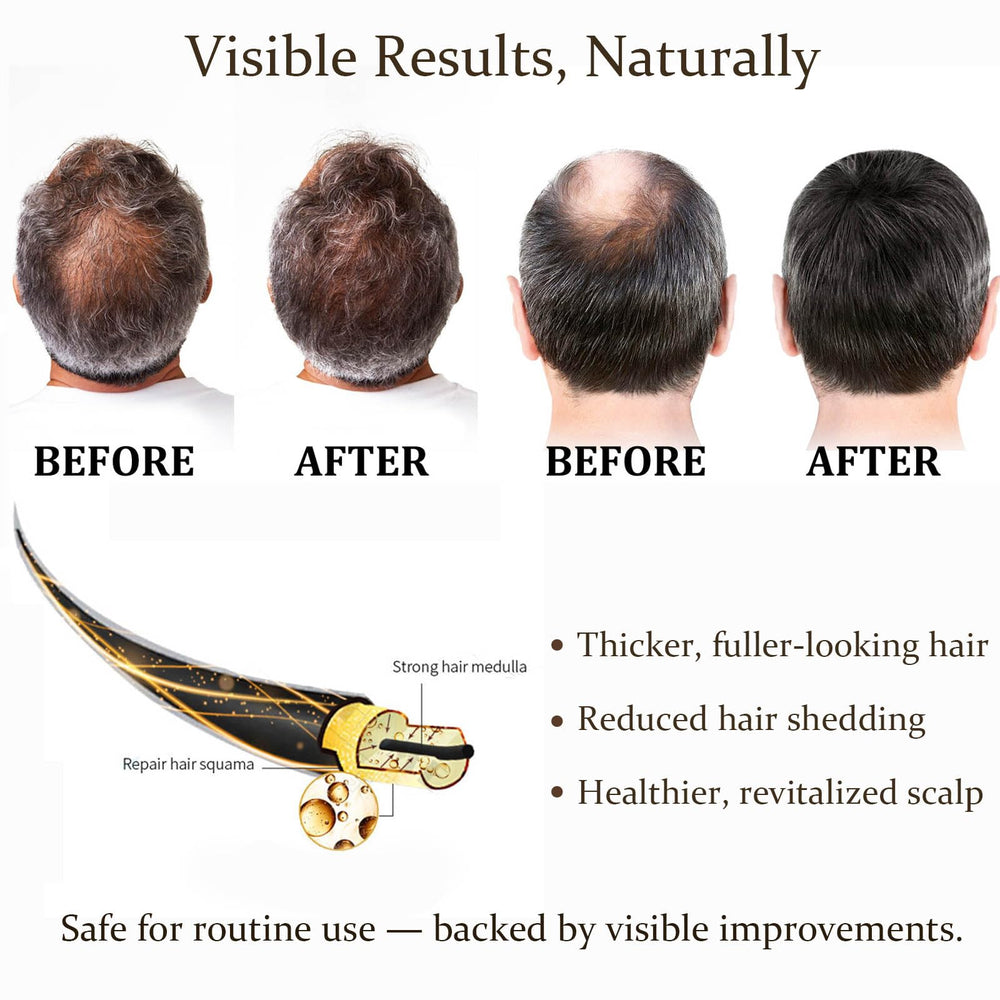 Boaccy Serum Apply-Scalp demonstrates fast-absorbing formula with no greasy residue.