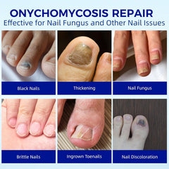 BOELIKAYS nail patches targeting discoloration for a smoother nail appearance.