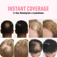 Boldify Hair Fibers crown-area application demonstrates easy, mess-free use.