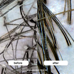 BondiBoost HG Clarifying Rinse scalp close-up shows balanced health.