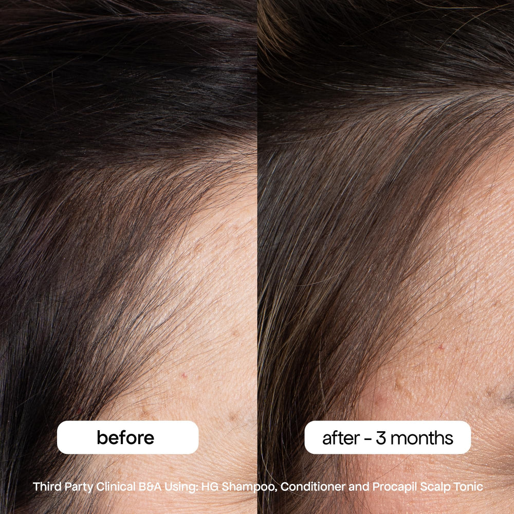 Clinical results graphic on packaging showing reduced shedding with BondiBoost HG