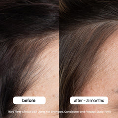 Clinical results graphic on packaging showing reduced shedding with BondiBoost HG