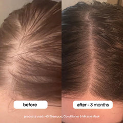 BONDIBOOST HG shampoo rosemary ingredient close-up supporting scalp health