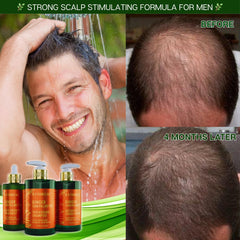BOTANICAL HAIR GROWTH LAB bottle-cap-and-label highlights premium scalp care