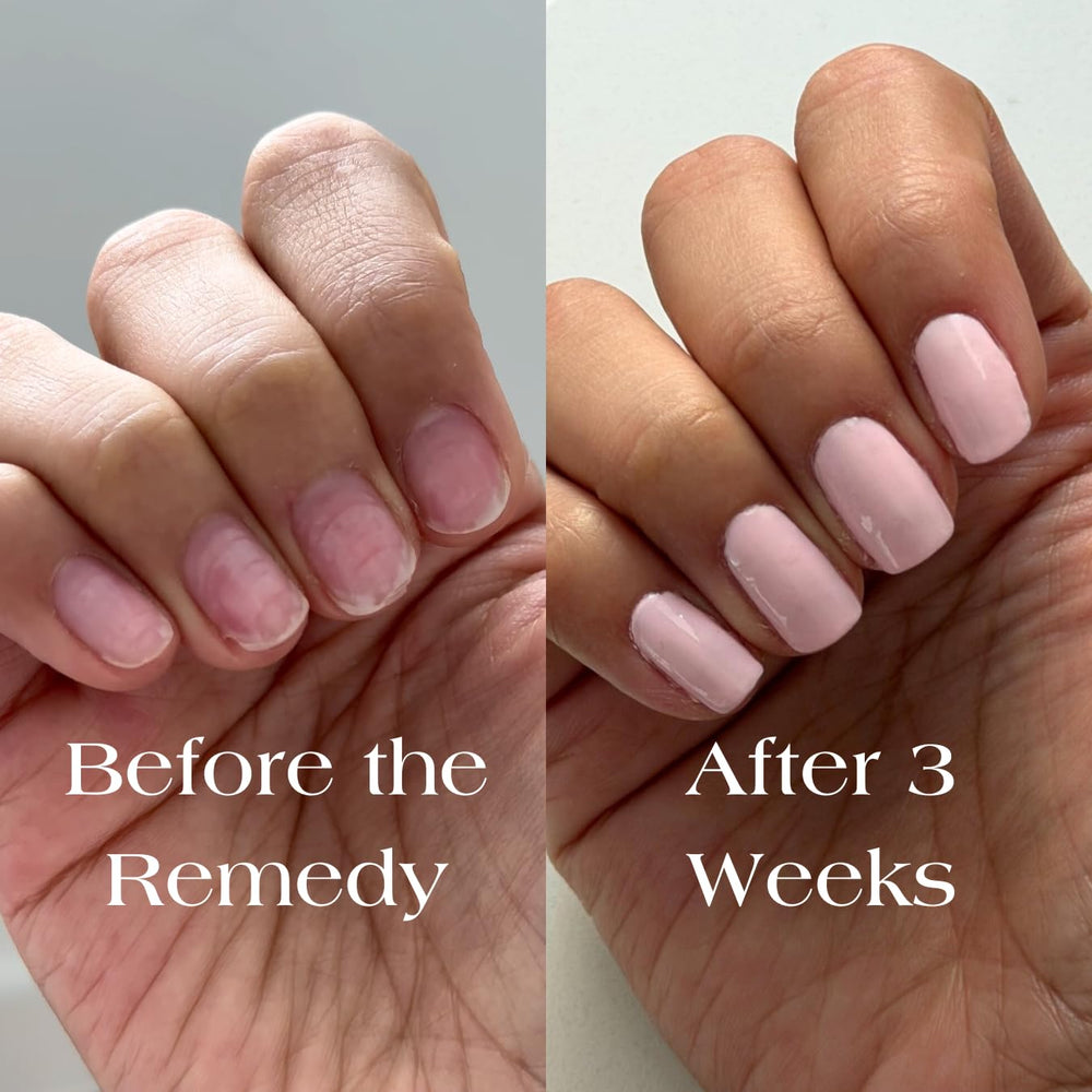 Botanist The Remedy demonstrates coverage of imperfections on nails.