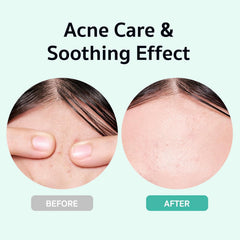 TeCa Liposome soothing formula close-up for gentle nourishment.