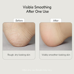 BuffOut being rubbed on a dry heel for gentle exfoliation.