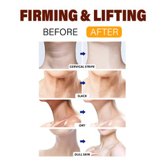 BYMOLIA fast-absorbing neck cream leaves no sticky residue.