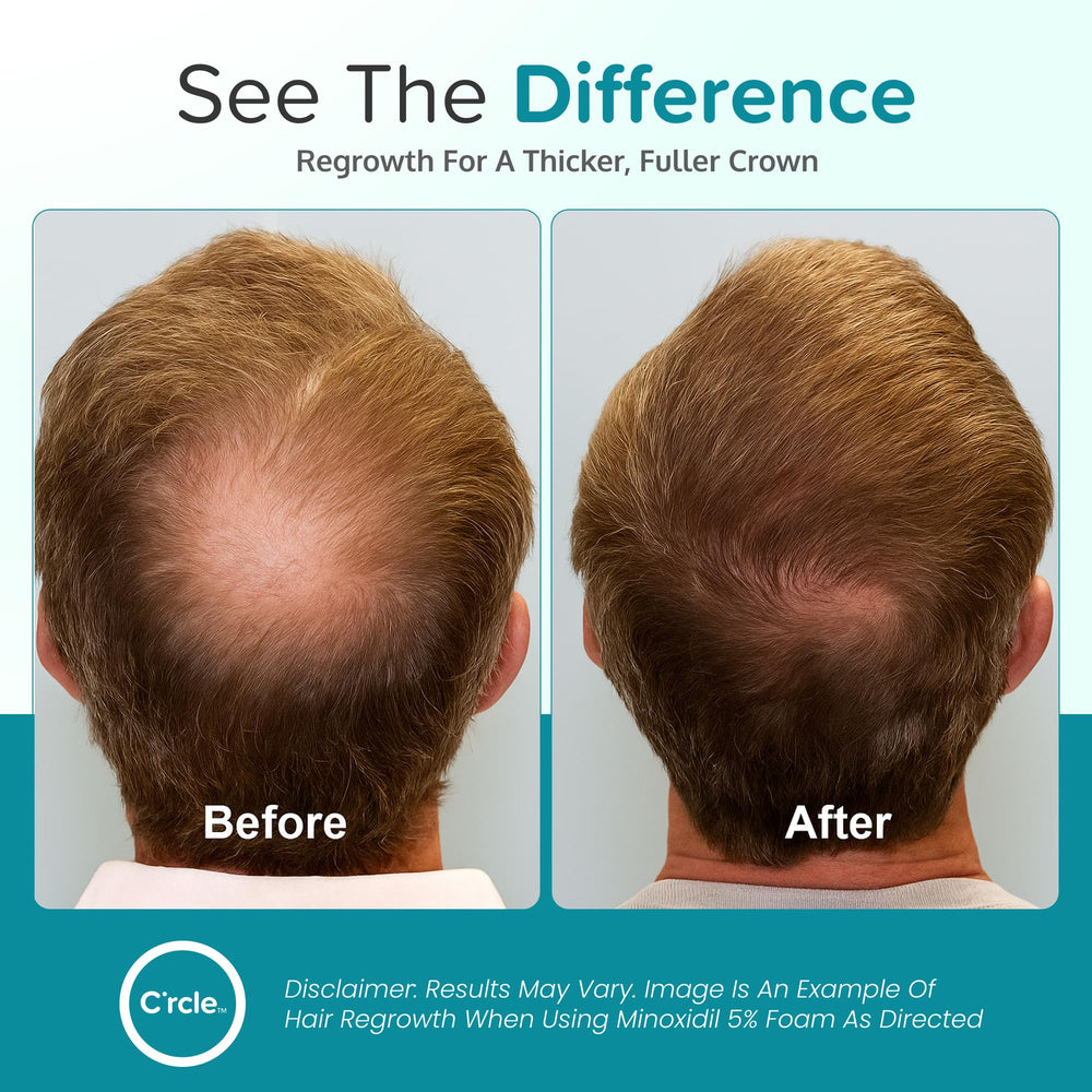 Smooth texture of C'rcle Minoxidil 5% Foam absorbed quickly into the scalp