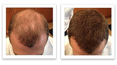 Caboki Auburn after-use shows fuller roots and seamless blend.