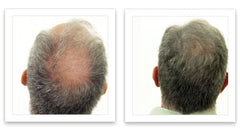 Caboki hair-fiber application scene demonstrates easy shake-on usage.