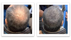 Caboki Hair Loss Concealer natural look blends with existing hair.