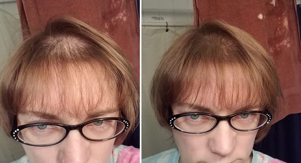 Caboki helps widen hair part for a fuller appearance