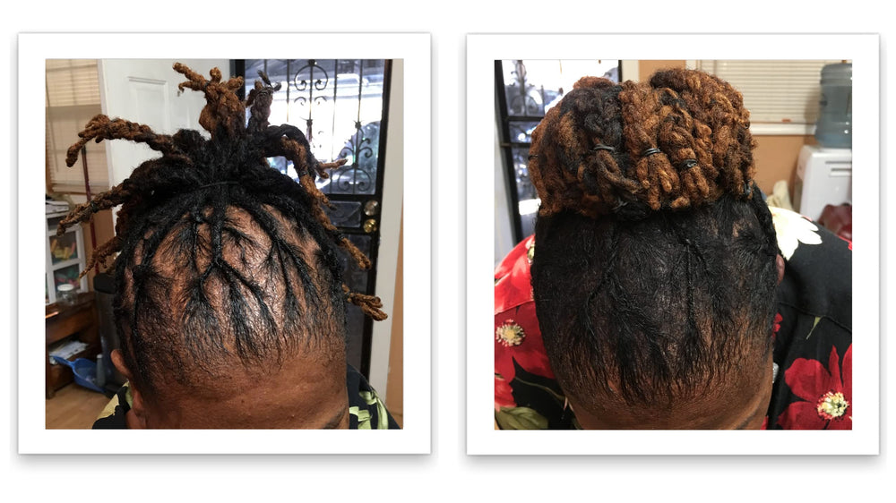 Caboki sparse hairline enhancement for balanced look.