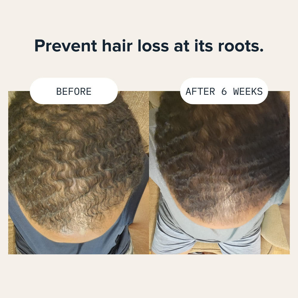 Man applying Cardon shampoo for a daily routine