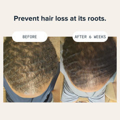 Man applying Cardon shampoo for a daily routine