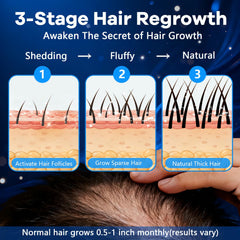 CARENICE Biotin-infused Minoxidil Foam label highlights added hair-supporting biotin.